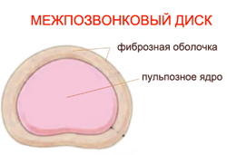 Міжхребцевий диск складається з хрящових (замикальних) пластинок примикає до тіл хребців фіброзного кільця і ​​розміщеного в його центральній частині пульпозного ядра