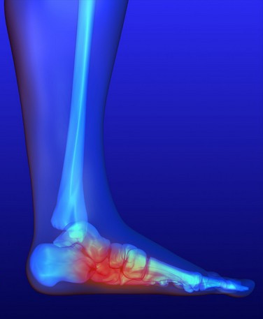 Вивихи стопи зустрічаються нечасто і складають близько 2% від числа всіх травматичних ушкоджень нижніх кінцівок людини