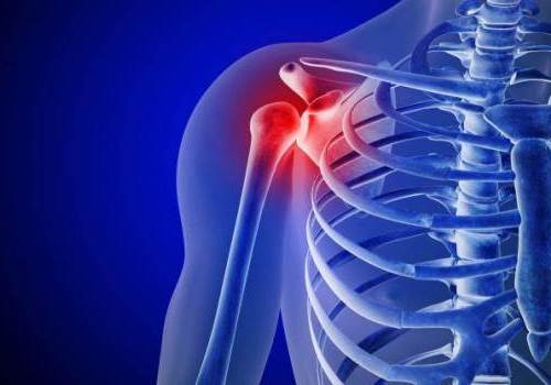 Плечовий суглоб є самим рухомим суглобом в тілі людини, тому що може здійснювати рухи в усіх трьох площинах